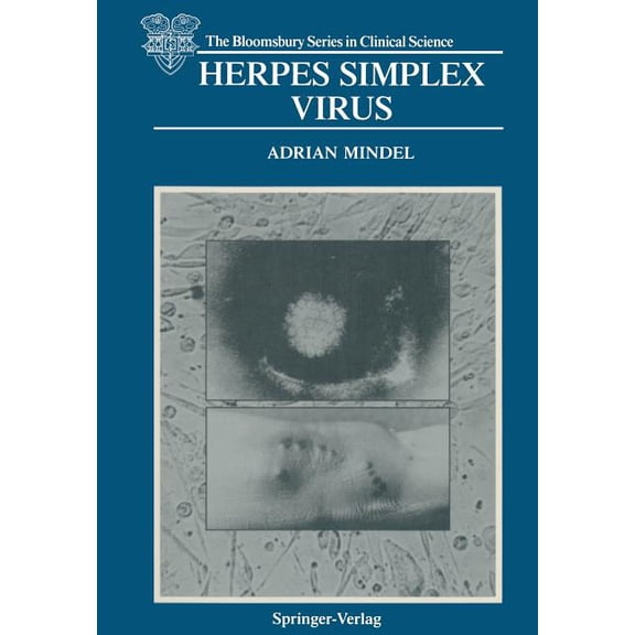 The Bloomsbury Clinical Science Herpes Simplex Virus, (Paperback)