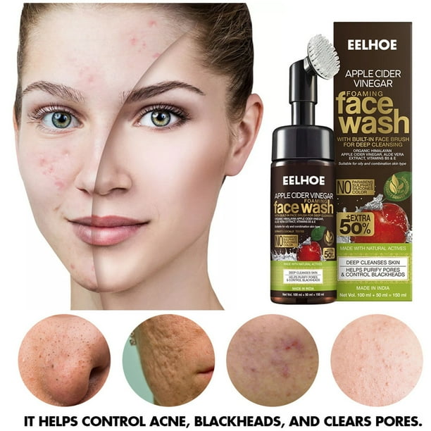 Apple Cider Vinegar Foam Cleansing Skin Acne Marks Facial Cleanser
