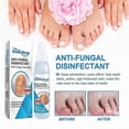 thumbnail image 3 of Nail Repair and Care Spray for Hands, Feet, and Nails - Strengthens, Cleans, and Polishes - 100ml, 3 of 5