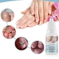 thumbnail image 1 of Líquido Reparador de Uñas Ganfancp 10Ml Esmalte de Uñas Rebajas Flash Deals, 1 of 7