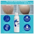 thumbnail image 3 of Loción FOOTLOGIX Cracked Heel Formula de 125 ml para piel seca, 3 of 9