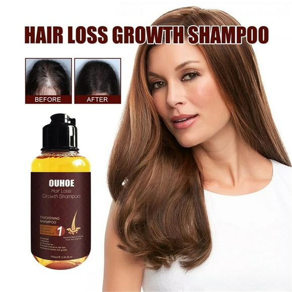 Latrodar Clarifying Shampoo Dandruff Shampoo Shampoo Women Strengthens&Nourishes Hair Growth Shampoo