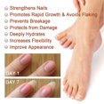 thumbnail image 4 of Suero Reparador De Uñas, Solución Para El Cuidado De Las Uñas, Refrescante Y Suave Para Las Uñas, 4 of 7
