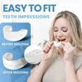 thumbnail image 6 of VitalSleep Adjustable Anti-Snoring Mouthpiece, Women's Size, 6 of 9