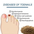 thumbnail image 7 of QARUN 2026 New Multi-Purpose Toenail Patches, Portable Mini Nail Repair Strips, Nighttime Renewal Nails Sticker Renew Appearance of Discolored Nails for Foot Care (32), 7 of 7