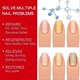 thumbnail image 5 of ExquisiteNail Repair Oil, Nail Repair Liquid for Growth, Mild Cuticle Conditioner, Nail Strengthener for Nails, Children, Adults, 5 of 5