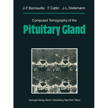 Computed Tomography of the Pituitary Gland -