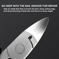 thumbnail image 3 of Nail Clippers for Thick & Ingrown Toenails - Sharp Curved Blade & Non-Slip Handle -Toenail Clippers for Men, Women, and Seniors, 3 of 5