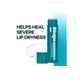 thumbnail image 5 of Bálsamo de Labios Medicado Blistex SPF 15 en Pack de 8, 5 of 8