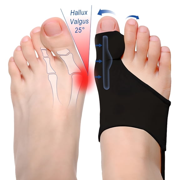 XIRQI Bunion Corrector for Women/Man Big Toe Straightener Bunion Corrector Relief Splints Reduce Pain and Correct Toe Alignment Brace Day/Night Fit for R/L, Washable (Black 2-Pack)