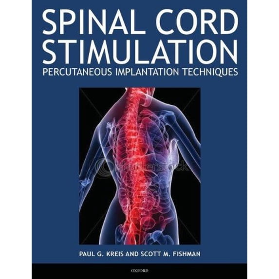 Pre-Owned Spinal Cord Stimulation: Percutaneous Implantation Techniques (Paperback) 0195393643 9780195393644