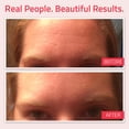 thumbnail image 4 of Sérum YEOUTH Retinol para rostro con ácido hialurónico, 60 ml, para toda la piel, 4 of 7