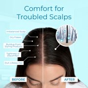 Tree To Tub Dry Scalp Spray - Tea Tree Leave in Scalp Moisturizer for Dry Scalp, Flaky Buildup & Excess Oil, Scalp Moisturizer for Men & Women 3.4 oz
