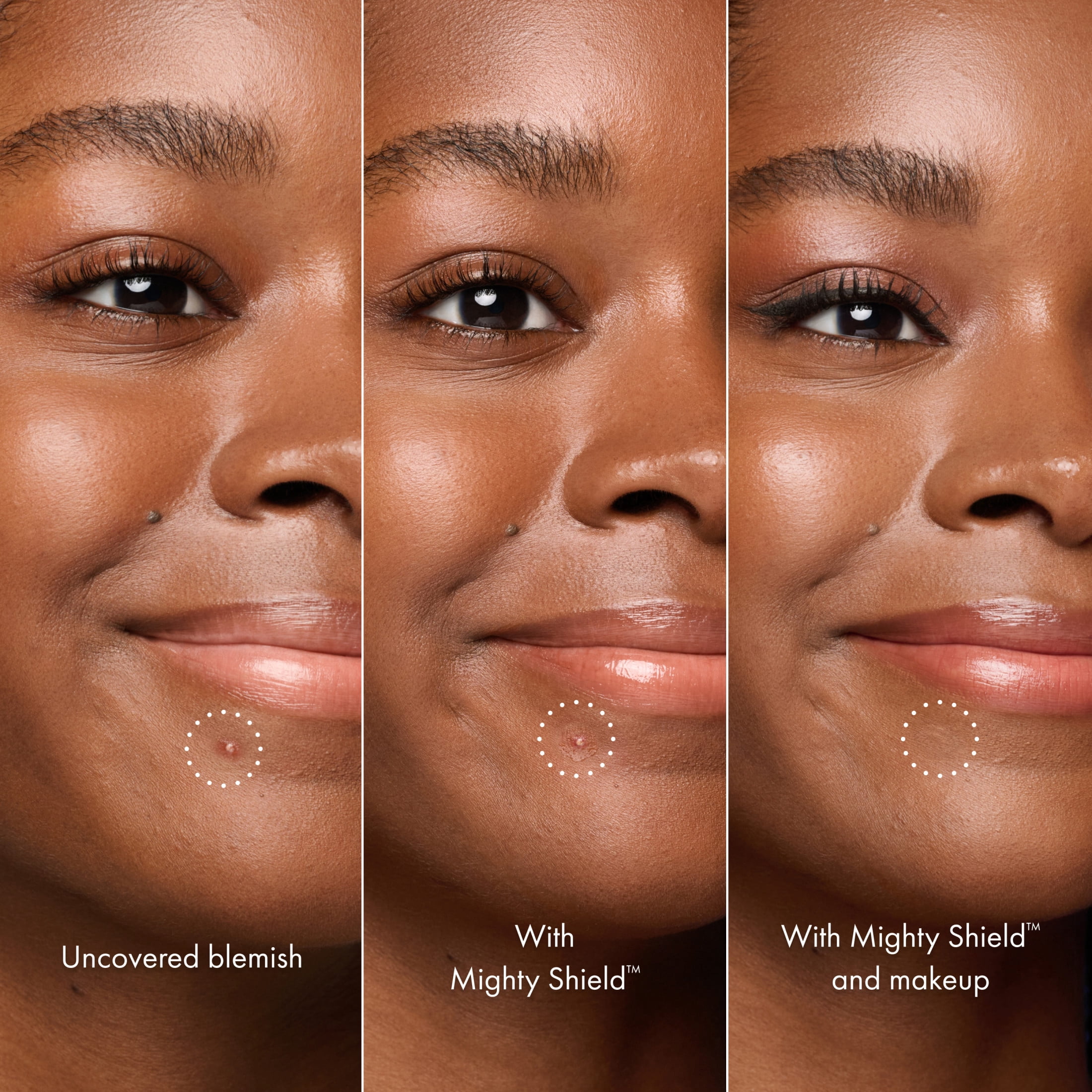 Hero Cosmetics Mighty Shield™ Liquid Patch Invisible Blemish Protectant, 10 ml Tube