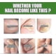 thumbnail image 5 of 2pcs South Moon Nail Care Roller Balls - 7-day Nail Growth Formula Nourishing Massage For Stronger, Faster-growing Nails, 5 of 5