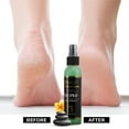 thumbnail image 5 of FOOTSPA - Pedi Spray Antiseptic, Mint & Eucalyptus - Refreshing Foot Care - 4 Ounces, 5 of 7