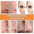 thumbnail image 2 of Turmeric Mud Mask Stick Acne Closing Acne Shrink Pores Deep Cleansing Skin Solid Mask -, 2 of 5