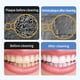thumbnail image 3 of Dental Removedores Cálculo Ultrasónico Enchufe USB en 5 Modos para Viajes A Casa, 3 of 9
