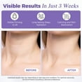 thumbnail image 3 of OUKEYA Retinol Neck and Chest Moisturizer for Firmer Skin and Wrinkle Reduction, 1.76 oz, 3 of 10