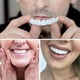 thumbnail image 4 of Fundas dentales postizas Smile Dental, carillas Perfect Smile, prótesis dentales Comfort Fit Flex., 4 of 5