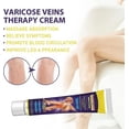 thumbnail image 5 of Crema para varices, alivio de varices en piernas, fortalecimiento de la salud capilar, crema para el cuidado de las arañas vasculares, 5 of 5