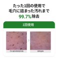 thumbnail image 4 of MainBasics Exfoliante de silicona para el cuerpo, exfoliante de ducha 2 en 1 para el cuerpo, lufa de silicona y masajeador del cuero cabelludo (cuerpo morado + cuero cabelludo), 4 of 5