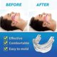 thumbnail image 5 of Adjustable Anti Snoring Mouth Guard Anti-snoring Mouthpiece Sleeping Devices Bruxism Snoring Stopper Improve Sleep Mouthpiece G, 5 of 5
