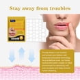 thumbnail image 4 of Parche de miel SOUTH MOON 60 parches para herpes labial, 4 of 8