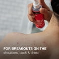 thumbnail image 4 of Spray para el acné Neutrogena Stubborn con ácido salicílico 162 ml, 4 of 5