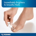 thumbnail image 4 of PROCLEARZ Brite Now, Clinically Proven, Breakthrough Technology! Peels Away Keratin Debris, 0.5 Ounce, 4 of 4
