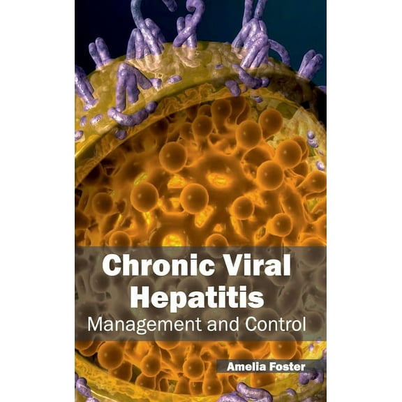 Chronic Viral Hepatitis: Management and Control, (Hardcover)