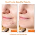 thumbnail image 3 of Set de cuidado facial, tónico, sérum y crema con vitamina C YEOUTH, 3 of 7