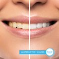 thumbnail image 2 of Set de viaje GO SMILE de gel blanqueador de dientes y pasta de dientes de lujo, 2 of 7