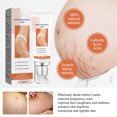 thumbnail image 3 of Scar Removal Cream,  2Pcs Stretch Mark Cream 45g Effective  for Body, 3 of 7