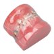 thumbnail image 5 of Modelo Dental de Ortodoncia NikouMX Resina, 5 of 8