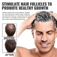 thumbnail image 5 of 3pcs Spartan Root Shampoo, Spartan Shampoo,shampoo Root, 5 of 5