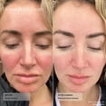 thumbnail image 4 of Crema facial Sente Dermal Repair para pieles propensas a la rosácea, 50 ml, 4 of 7