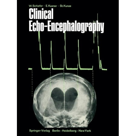 UPC: 9783642487231 | Clinical Echo-Encephalography (Paperback)