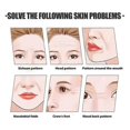 thumbnail image 2 of Jaysuing Face Lipper Tightness Lipper Face French Ribb Fine Wrinkle Skin Sag Anti-Wrinkle Face Lipper - 1Pcs, 2 of 4