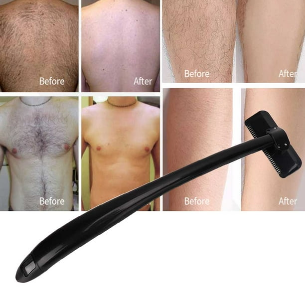 Depilación Definitiva Depilacion De Espalda Para Hombres Vellos