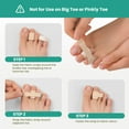 thumbnail image 3 of Welnove Hammer Toe Straightener , 8 Pack Broken Toe Wraps , Hammer Toe Corrector for Women,Size S, Beige, 3 of 7