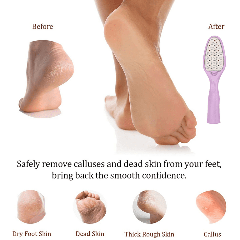 Best Foot care pedicure metal surface tool to remove hard skin. Can be Used on both wet and dry feet Purple Walmart