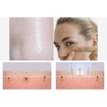 thumbnail image 2 of Electric Blackhead Remover Set Rechargeable Acne Remover Comedone Remover, 2 of 10