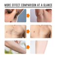thumbnail image 3 of Hair Removal Cream Whole Body Depilatory Cream for Women and Men Mild Hair Remover Cream for Arms Legs Armpits, 3 of 4