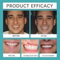thumbnail image 4 of 2x Dientes postizos de quita y pon superiores e inferiores, carillas dentales instantáneas, dentaduras postizas, cubiertas para dientes, 4 of 4