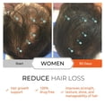 thumbnail image 4 of Tabletas para el crecimiento del cabello DS LABORATORIES Revita para mujeres y hombres, 4 of 9