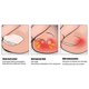 thumbnail image 5 of Multifunctional Nail Clippers Folding Olecranon Arch Ingrown Pliers for ParonychiaBlack, 5 of 5
