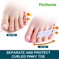 thumbnail image 3 of Separadores de dedos Povihome Triple Gel para dedos superpuestos, color rosa, 3 of 8