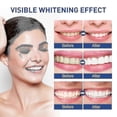 thumbnail image 2 of Tooth Cleaner Stain Remover Brightener Whitener Teeth Tobacco Yellow Jaysuing | |, 2 of 3