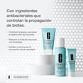 thumbnail image 4 of Clinique Acne Solutions Cleansing Foam | Espuma Limpiadora Facial con 2% de Ácido Salicílico | Ayuda a Tratar Brotes e Imperfecciones, 4 of 5